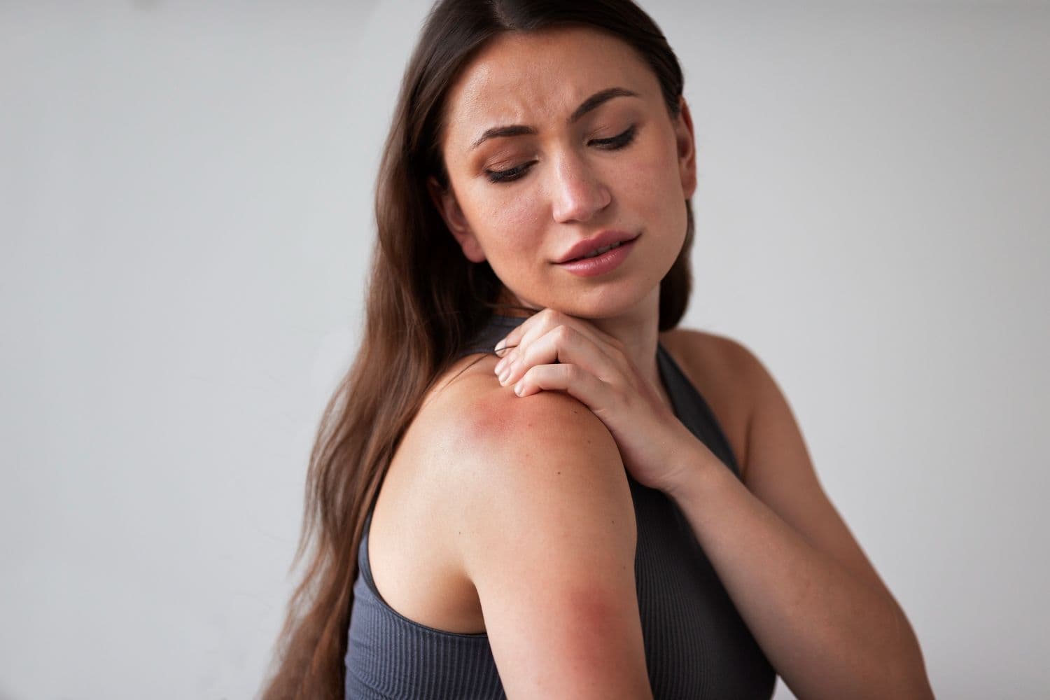 skin rashes