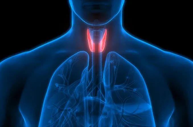 Illustration of an overactive thyroid gland affected by Graves' disease