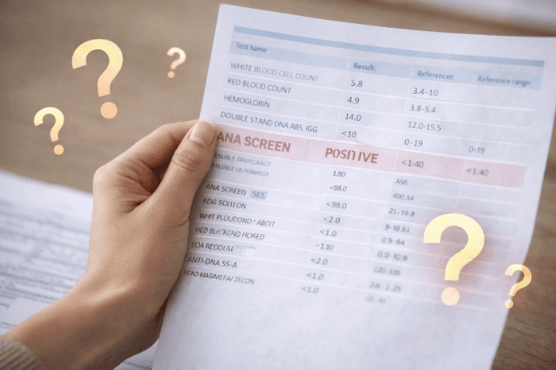 If My ANA Is Positive Do I Have an Autoimmune Disease?