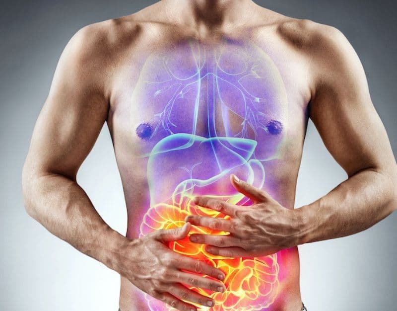 Illustration of the digestive tract affected by inflammatory bowel disease