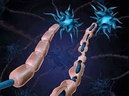 Person managing daily life with multiple sclerosis