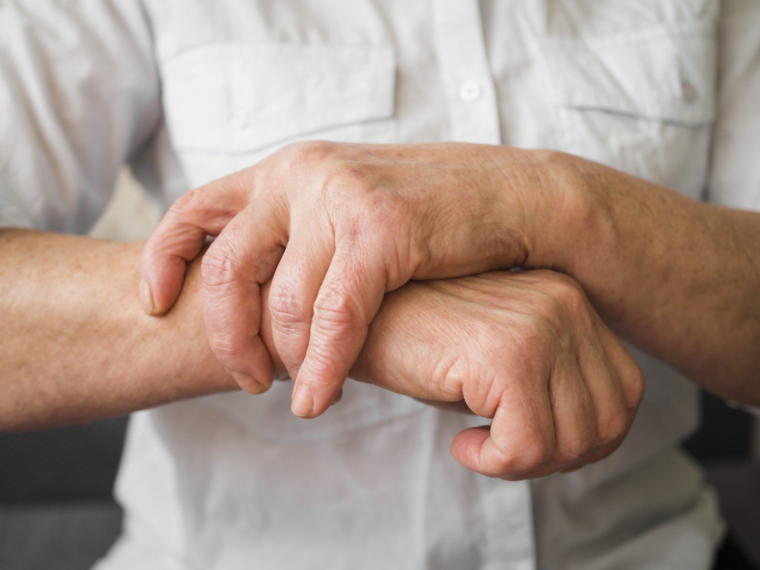 Close-up of a patient's swollen wrist joint from rheumatoid arthritis