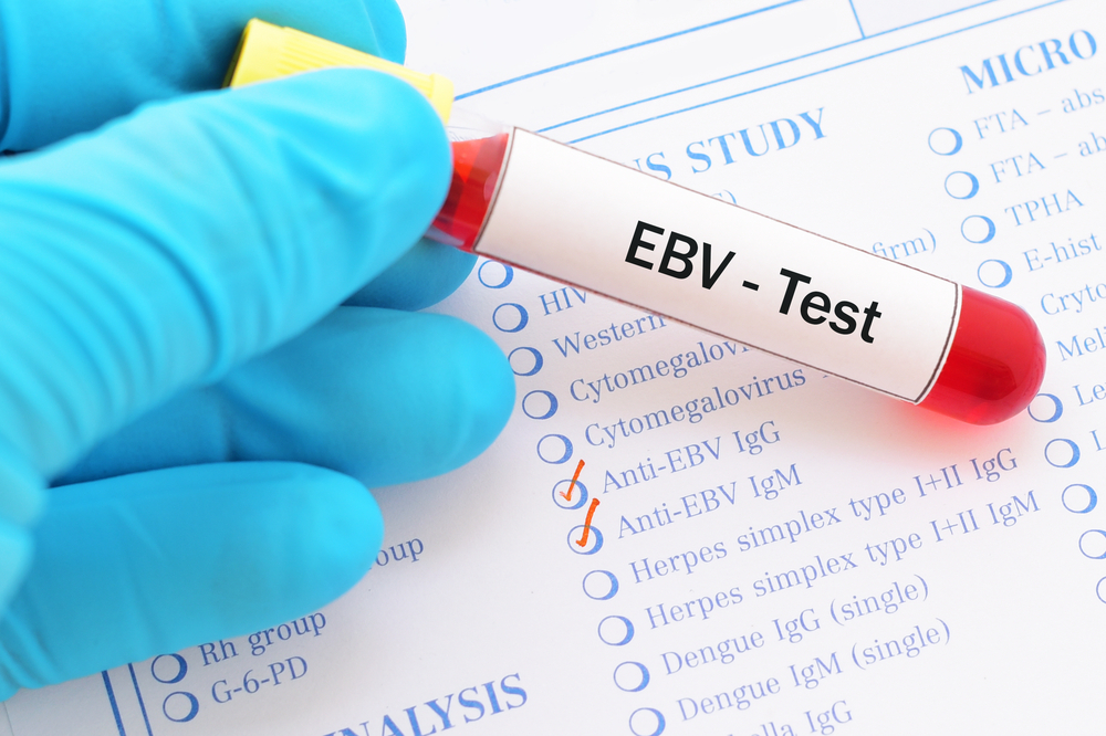 EBV test